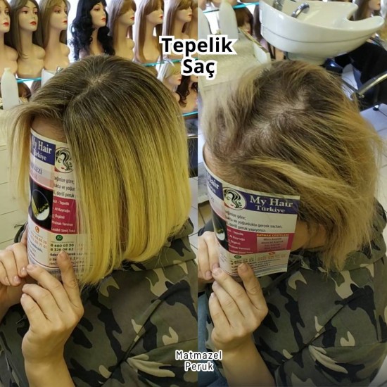 Tül Tepelik Merkezi İpek Taban Tepelik Ankara Kızılay