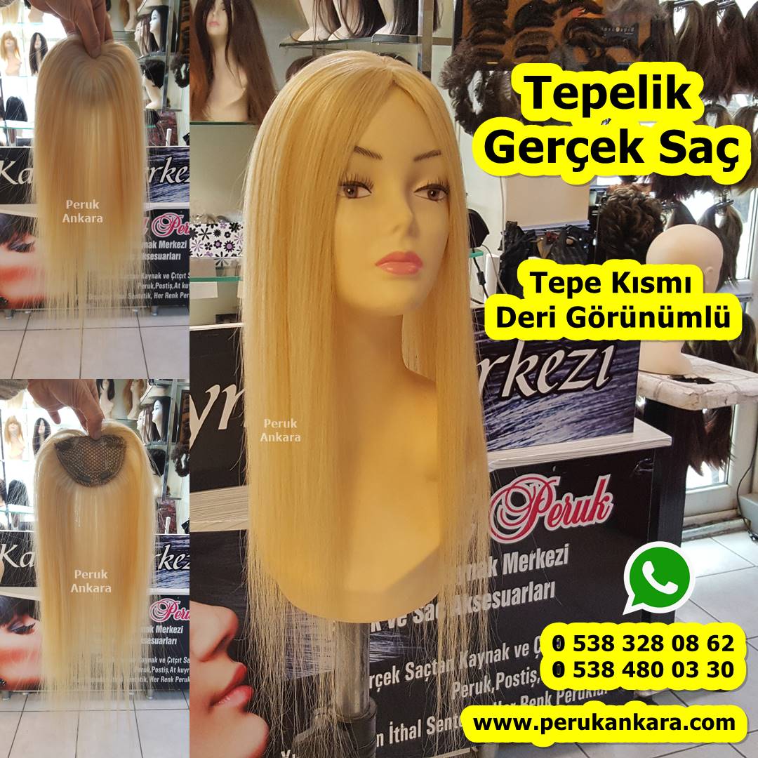 tepelik saç istanbul