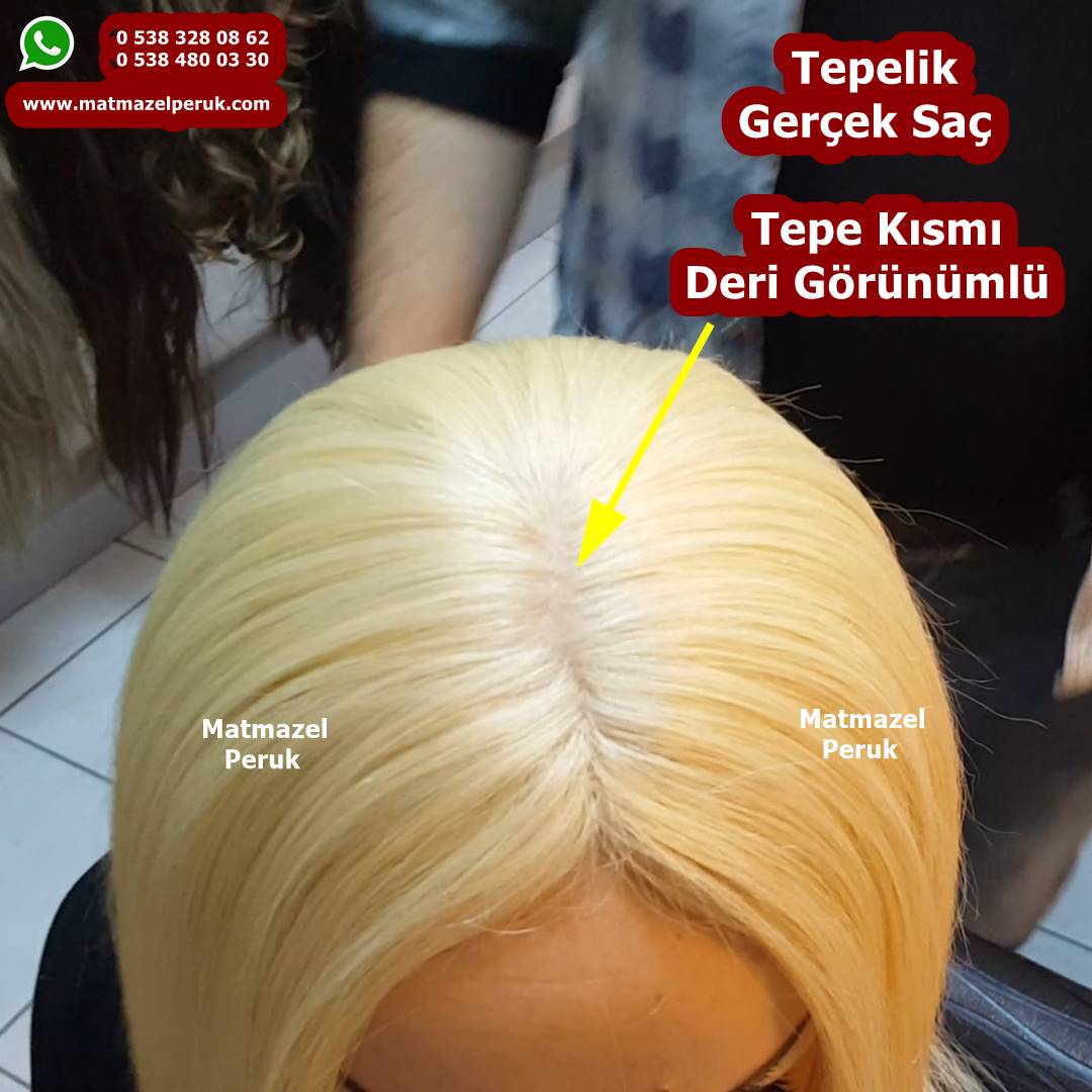 tepelik saç ankara