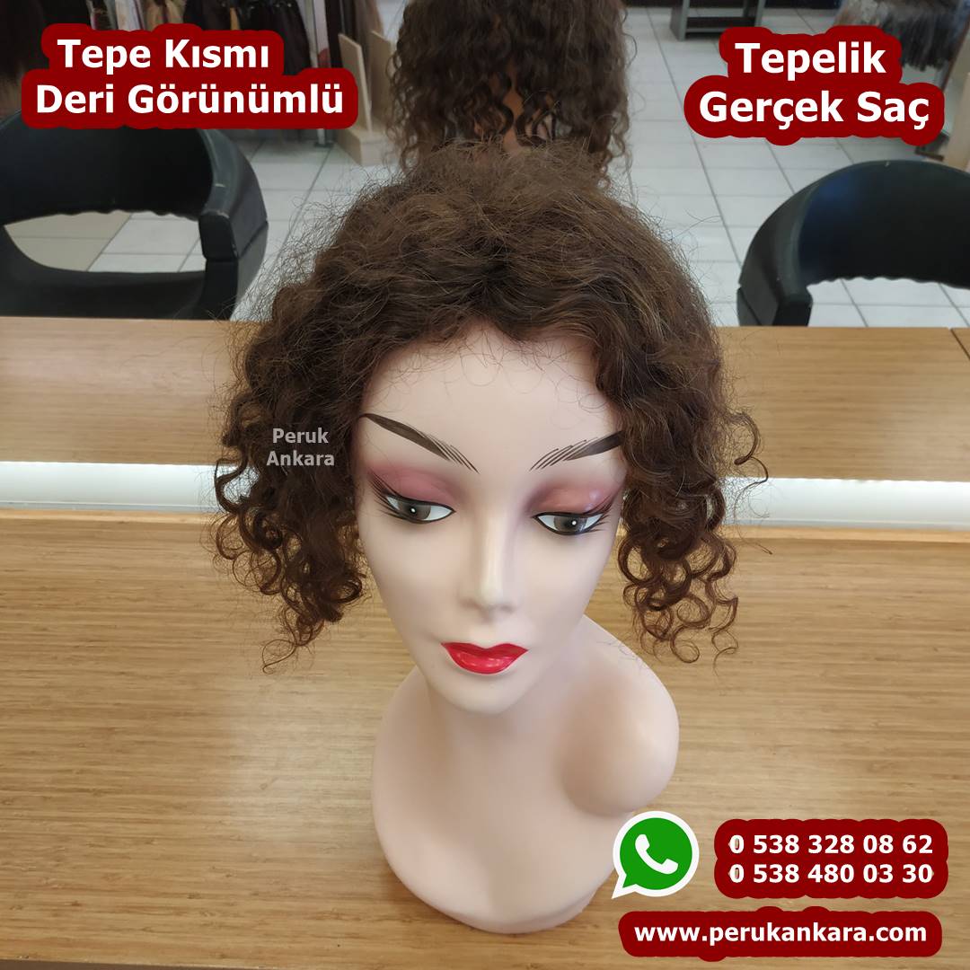 tepelik saç ankara