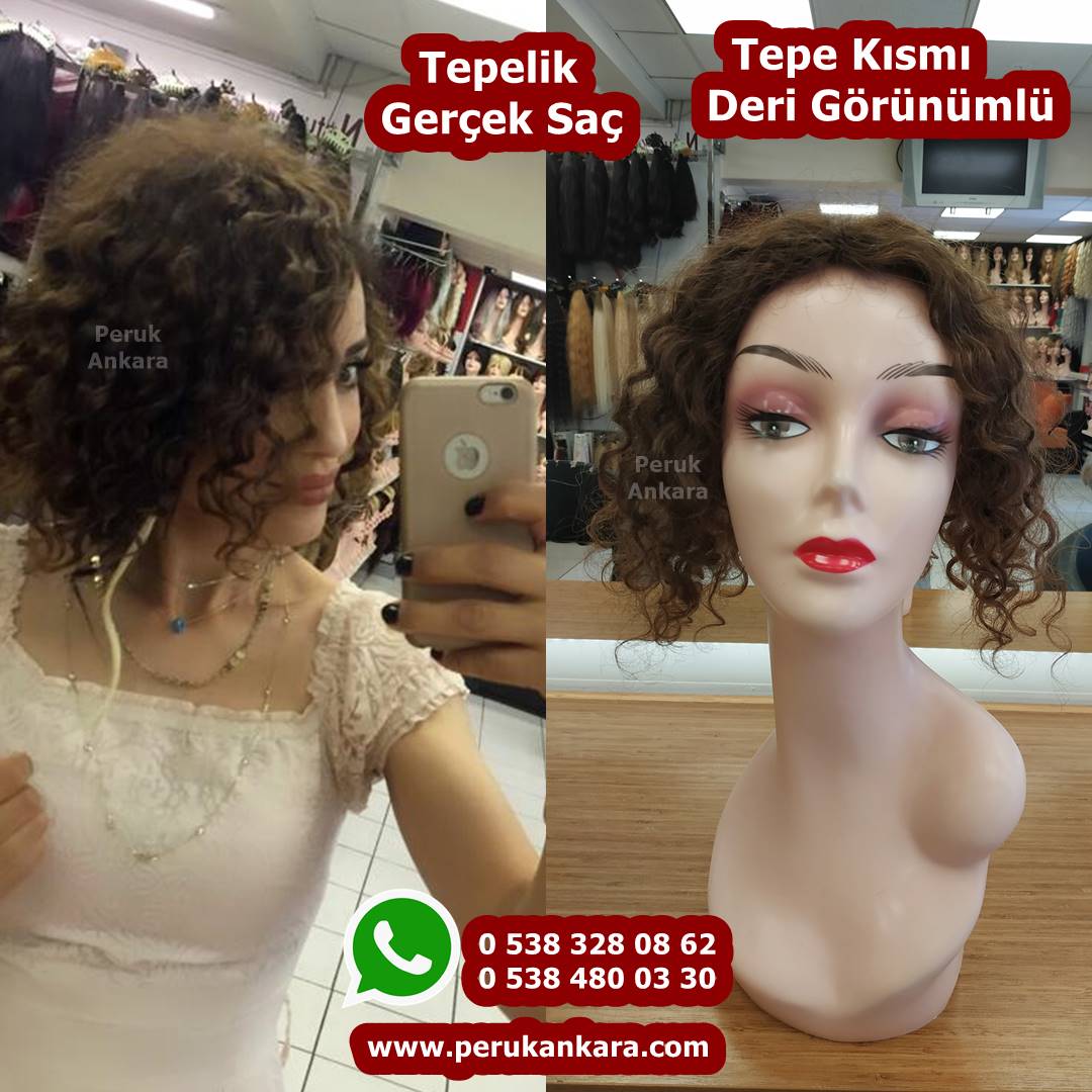 tepelik saç ankara